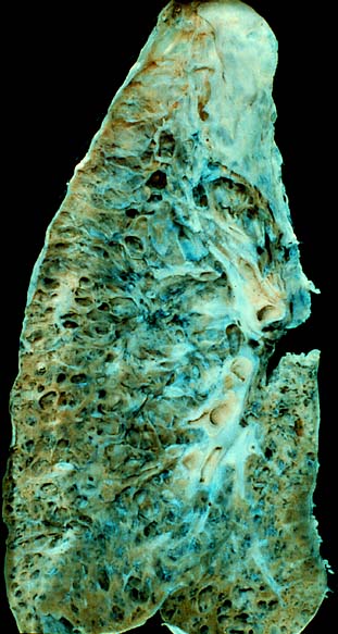honeycomb